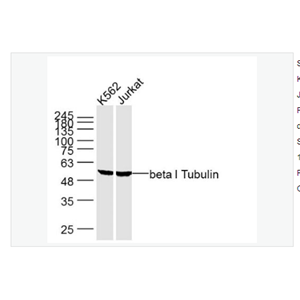 Anti-beta I Tubulin -微管蛋白β1单克隆抗体,beta I Tubulin (Loading Control)