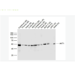 Anti-AKT1 antibody -蛋白激酶B重组兔单克隆抗体