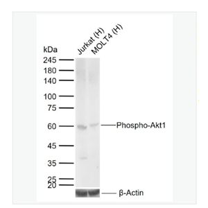 Anti-Phospho-Akt1  antibody -磷酸化Akt1重组兔单克隆抗体,Phospho-Akt1 (Ser473)