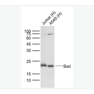 Anti-Bad antibody -相关死亡促进因子Bad重组兔单克隆抗体