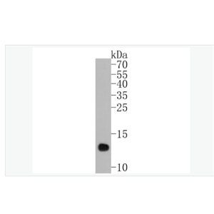 Anti-Histone H4 antibody -组蛋白H4重组兔单克隆抗体