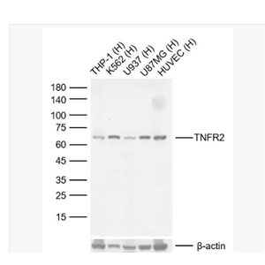 Anti-TNFR2 antibody -腫瘤壞死因子受體2重組兔單克隆抗體,TNFR2