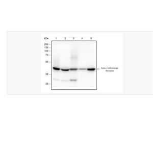 Anti-ADRB2 antibody-肾上腺素能受体β2重组兔单克隆抗体
