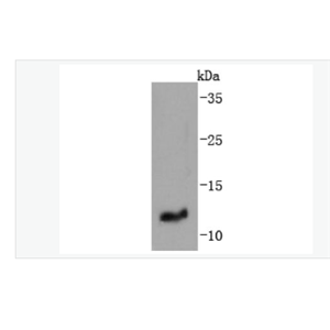 Anti-IGF2 antibody -胰岛素样生长因子-II重组兔单克隆抗体