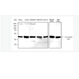 Anti-Pan Actin antibody -泛肌动蛋白重组兔单抗