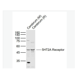 Anti-5HT2A Receptor antibody-5-羟色胺受体2A抗体