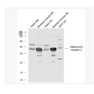 Anti-Adiponectin receptor 2 antibody-脂联素受体2抗体