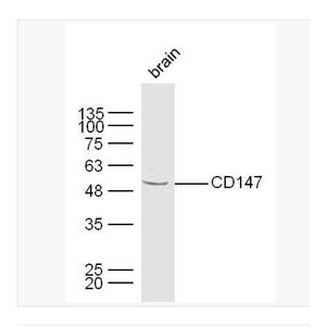 Anti-CD147 antibody-细胞外基质金属蛋白酶诱导因子抗体