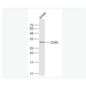 Anti-CDK1 antibody-周期素依赖性激酶1抗体,CDK1