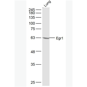 Anti-Egr1 antibody-早期生长应答蛋白1抗体