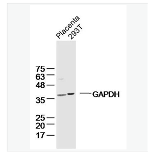 Anti-GAPDH antibody-3-磷酸甘油醛脱氢酶(内参)单克隆抗体,GAPDH (Loading Control)