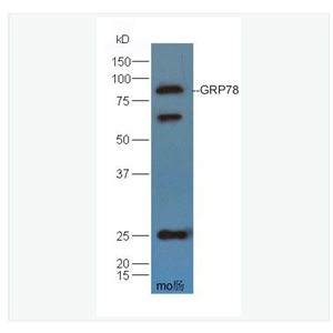 Anti-GRP78 antibody-葡萄糖调节蛋白78/热休克蛋白70蛋白5抗体