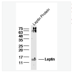 Anti-Leptin antibody-瘦素抗体,Leptin