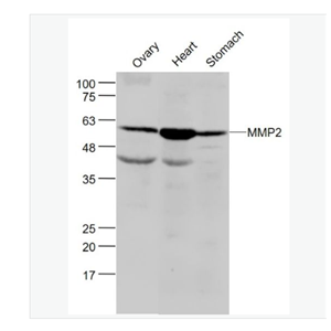 Anti-MMP2 antibody-基质金属蛋白酶2抗体,MMP2