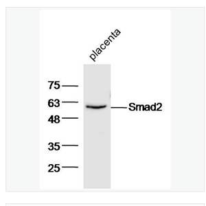 Anti-Smad2 antibody-细胞信号转导分子Smad-2抗体