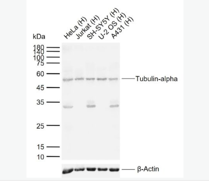 Anti-Tubulin-alpha antibody-微管蛋白α/Tubulin α（內(nèi)參）抗體,Tubulin-alpha (Loading Control)