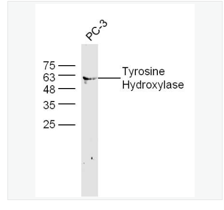 Anti-Tyrosine Hydroxylase antibody-酪氨酸羥化酶抗體,Tyrosine Hydroxylase