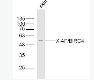 Anti-XIAP/BIRC4 antibody-X-连锁凋亡蛋白/性连锁凋亡抑制蛋白抗体,XIAP/BIRC4