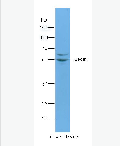 Anti-Beclin 1 antibody-自噬效应蛋白Beclin 1抗体,Beclin 1