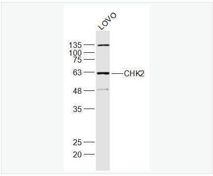 Anti-CHEK2 antibody-细胞周期检测点激酶2抗体,CHEK2