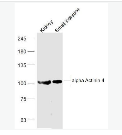 Anti-alpha Actinin 4 antibody-α-輔肌動(dòng)蛋白4抗體,alpha Actinin 4