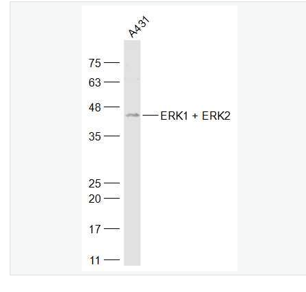 Anti-ERK1 + ERK2 antibody-丝裂原活化蛋白激酶1/2抗体,ERK1 + ERK2