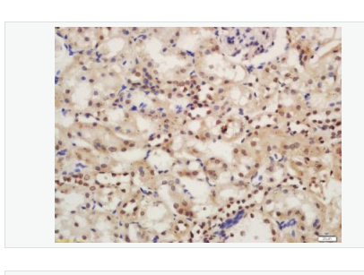 Anti-Phospho-IRAK1 (Ser376) antibody-磷酸化白介素-1受體相關(guān)激酶1抗體,Phospho-IRAK1 (Ser376)