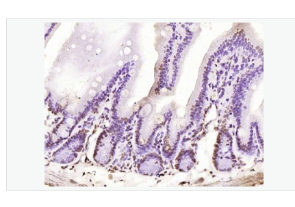 Anti-phospho-PKC delta (Tyr311) antibody-磷酸化蛋白激酶C亚性D型抗体,phospho-PKC delta (Tyr311)