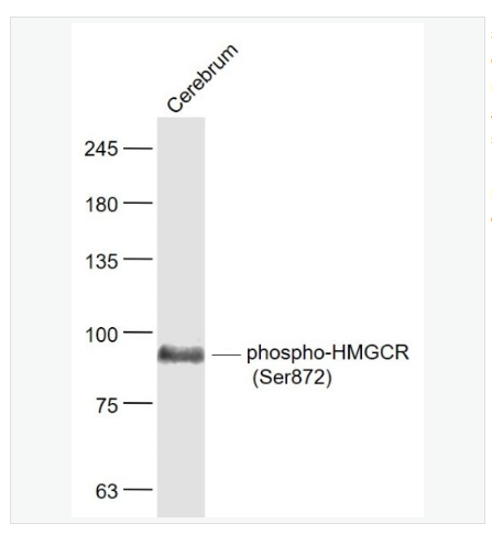 Anti-phospho-HMGCR antibody -磷酸化三羥基三甲基輔酶A還原酶抗體,phospho-HMGCR (Ser872)