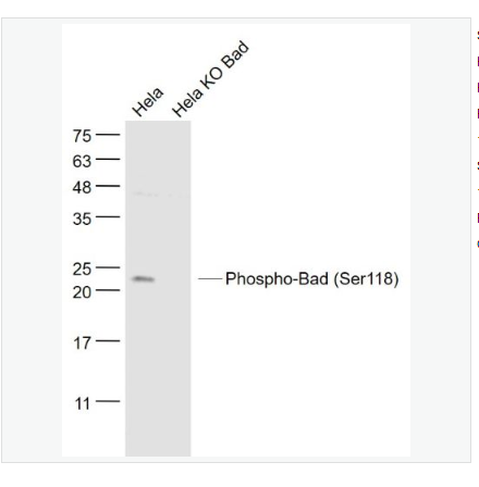 Anti-Phospho-Bad antibody -磷酸化相关死亡促进因子抗体,Phospho-Bad (Ser118)