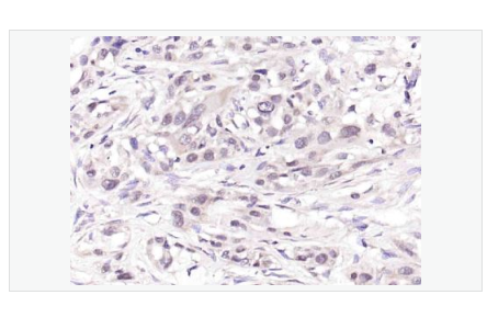 Anti-phospho-CDKN1A/p21antibody -磷酸化p21蛋白抗體,phospho-CDKN1A/p21 (Ser130)