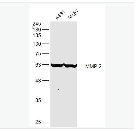 Anti-MMP-2 antibody -基质金属蛋白酶2抗体,MMP-2