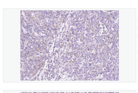 Anti-Sclerostin  antibody -骨形态发生抑制蛋白SOST抗体,Sclerostin