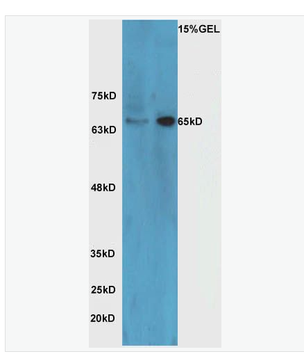 Anti-HRG beta 1 antibody -乳腺癌细胞分化因子P45抗体,HRG beta 1