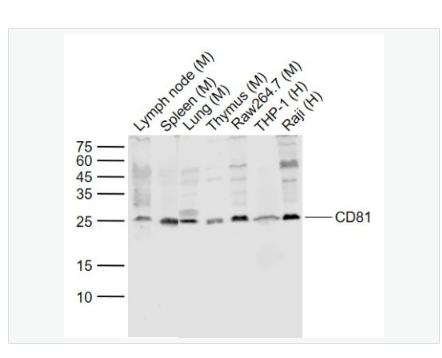 Anti-CD81  antibody -CD81抗体,CD81