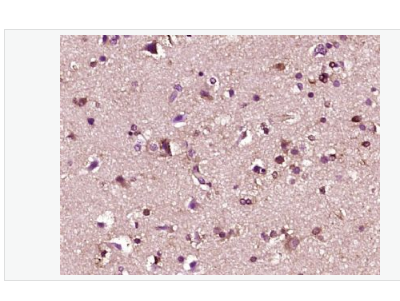 Anti-Fbxw7  antibody -Fbxw7蛋白抗体,Fbxw7