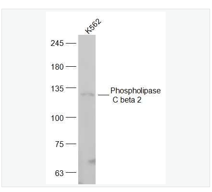 Anti-Phospholipase C beta 2  antibody -磷酯酶Cβ2抗體,Phospholipase C beta 2