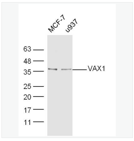 Anti-VAX1 antibody -視神經(jīng)視網(wǎng)膜相關(guān)蛋白VAX1抗體,VAX1