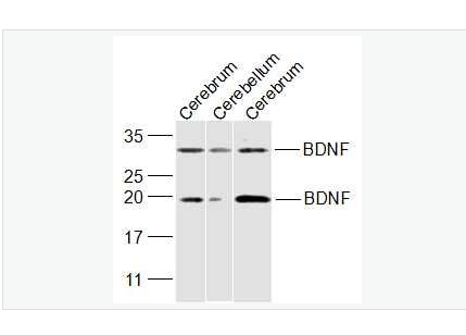 Anti-BDNF antibody-脑源神经营养因子抗体,BDNF