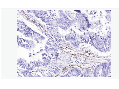 Anti-Von Willebrand Factor antibody-血管假性血友病因子/血管性血友病因子抗体,Von Willebrand Factor