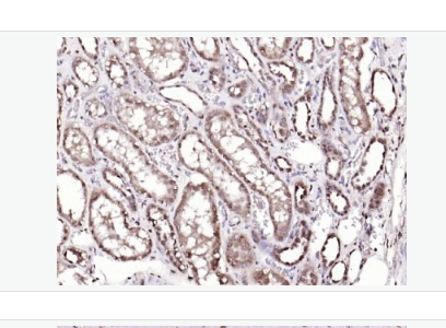 Anti-ADRM1 antibody-粘附調(diào)節(jié)分子1抗體,ADRM1