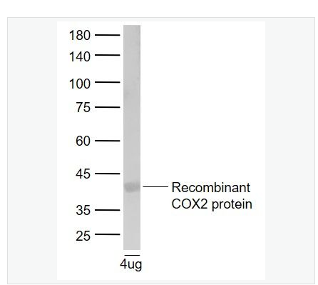 Anti-Cyclooxygenase 2 antibody-环氧合酶2/前列腺素内过氧化物合成酶2抗体,Cyclooxygenase 2