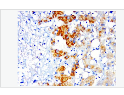 Anti-PSMD14 antibody-蛋白酶调解因子14抗体,PSMD14