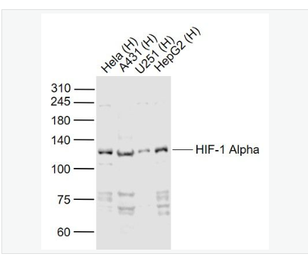 Anti-HIF-1 Alpha antibod-缺氧诱导因子1α /HIF-1α抗体,HIF-1 Alpha