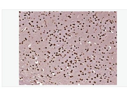 Anti-Histone H3(mono methyl K79) antibody-甲基化组蛋白H3(mono methyl K79)单克隆抗体,Histone H3(mono methyl K79)