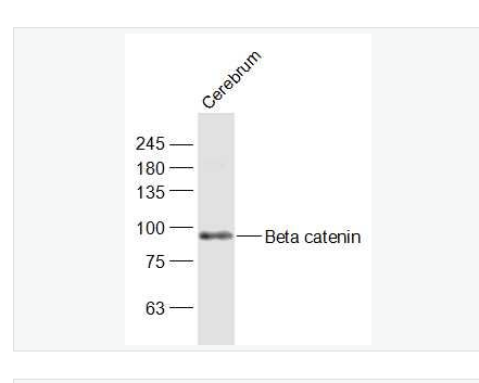 Anti-Beta catenin antibody-β-连环蛋白/β-连环素/β链接素抗体,Beta catenin