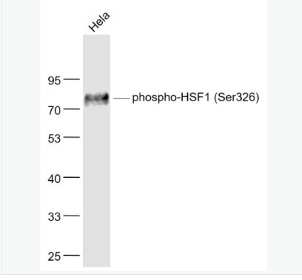 Anti-phospho-HSF1 (Ser326) antibody-磷酸化热休克因子1重组兔单克隆抗体,phospho-HSF1 (Ser326)