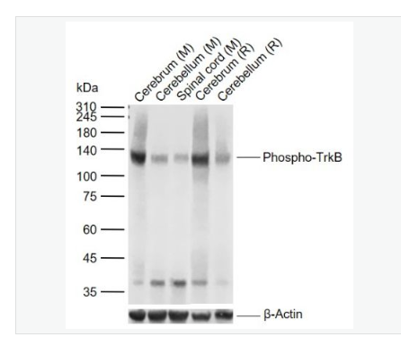 Anti-Phospho-TrkB (Tyr817) antibody-磷酸化酪氨酸激酶B(Tyr817)重组兔单克隆抗体,Phospho-TrkB (Tyr817)