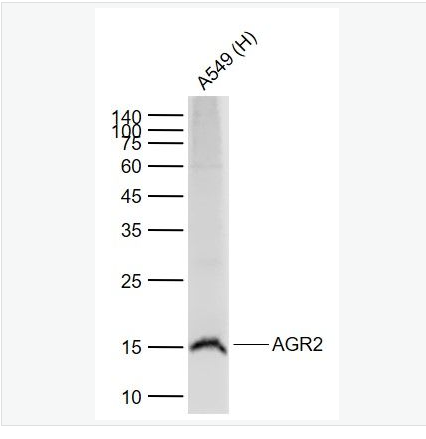 Anti-AGR2 antibody-前梯度同源蛋白2重组兔单克隆抗体,AGR2