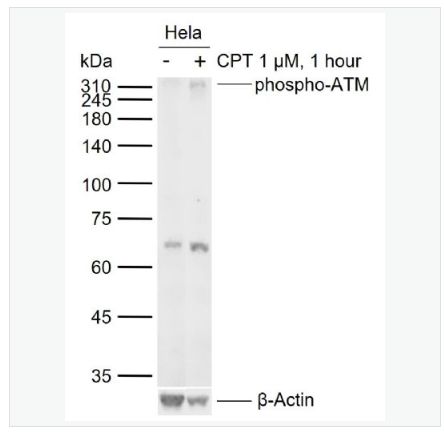 Anti-phospho-ATM (Ser1981) antibody-磷酸化ATM(Ser1981)重组兔单克隆抗体,phospho-ATM (Ser1981)